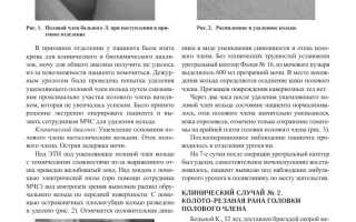Член пострадал в бою? Что делать после сексуальной травмы и как восстановиться
