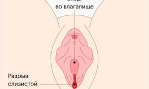 Секс после кесарева: ну когда уже можно, и что важно знать?
