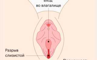 Секс после кесарева: ну когда уже можно, и что важно знать?